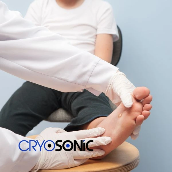 Are you looking for fast effective wart removal Contact us today Scarborough
