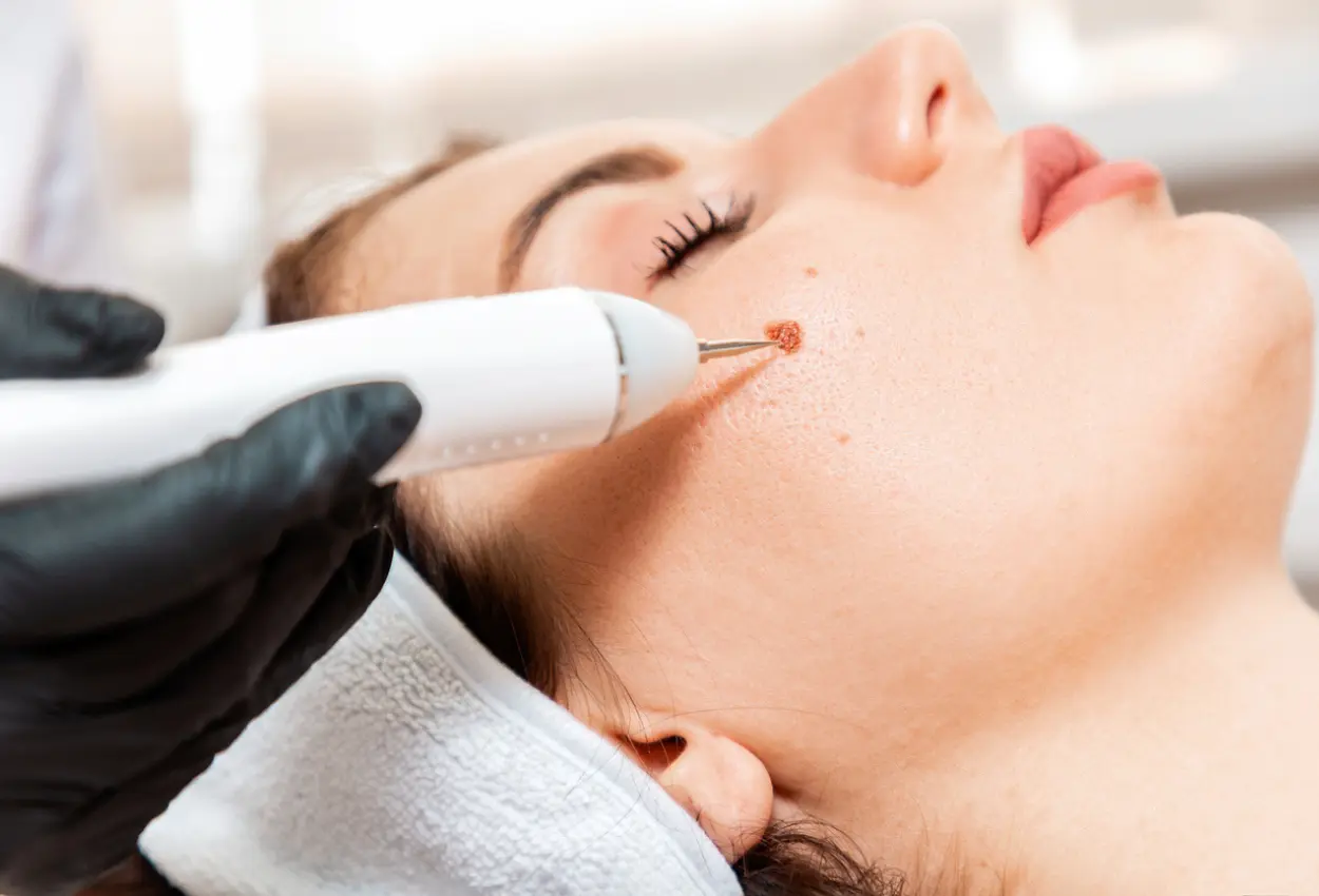 Frequently Asked Questions About Multiple Cryotherapy Treatments Scarborough