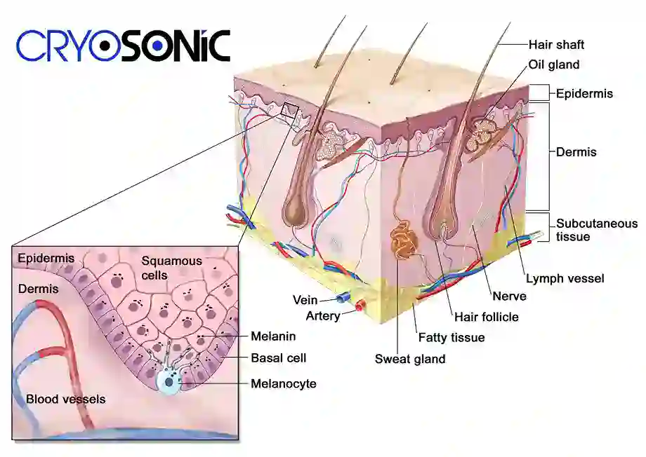 How Cryotherapy Stimulates Melanocyte Activity Scarborough